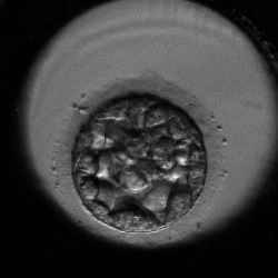 Embryo #4000